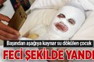Başından aşağıya kaynar su dökülen çocuk feci şekilde yandı