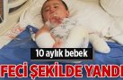 10 aylık bebeğin üzerine çaydanlık devrildi