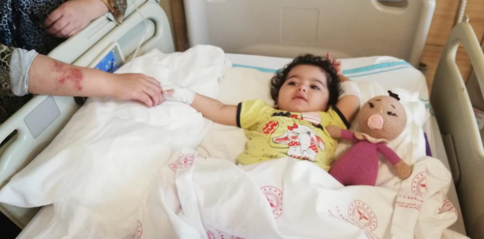 Sobadan devrilen çaydanlık minik Eslem’i yaktı