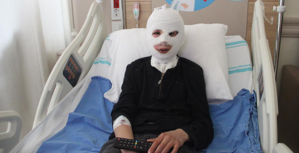 Sobada ayaklarını ısıtırken kendini yaktı